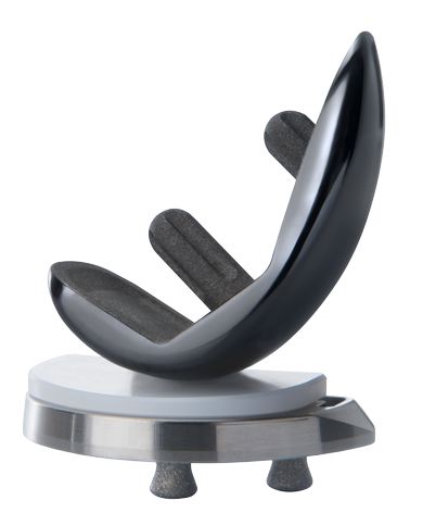 UKA（人工膝関節単顆置換術）インプラント